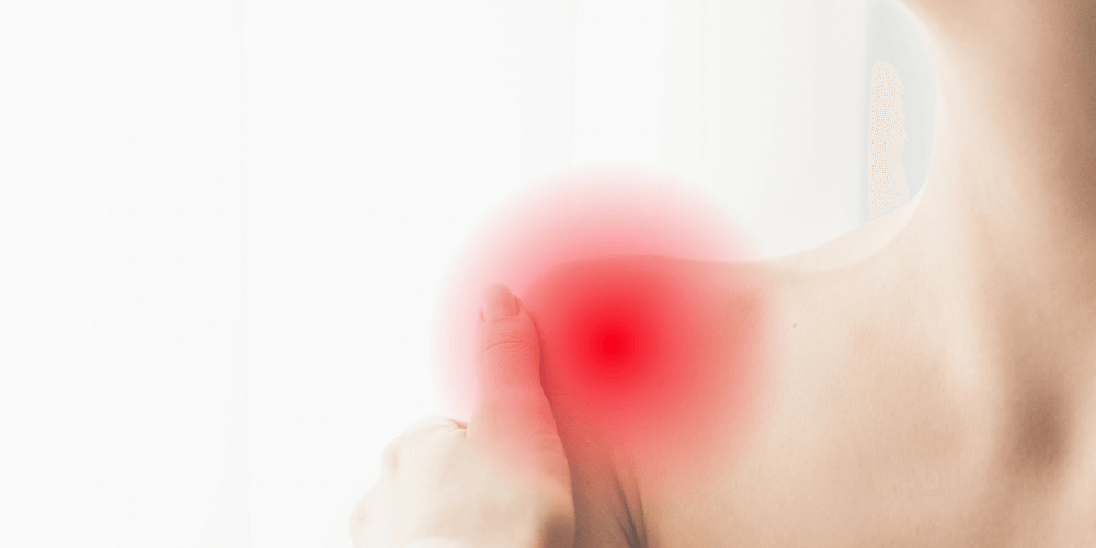 Schouder fysiotherapie